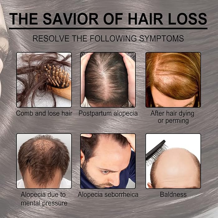 Rosemary Hair Growth Essential Oil Prevent Hair Loss Nourish Scalp Strengthen Hair